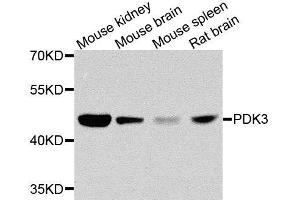 Western blot analysis of extracts of various cell lines, using PDK3 antibody. (PDK3 anticorps  (AA 137-406))