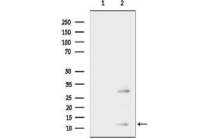 anti-TGFB1-Induced Anti-Apoptotic Factor 1 (TIAF1) (C-Term) antibody