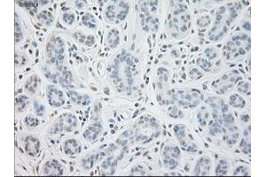 Immunohistochemical staining of paraffin-embedded breast tissue using anti-GAD1 mouse monoclonal antibody. (GAD anticorps)