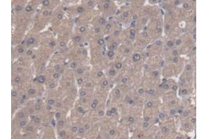 DAB staining on IHC-P; Samples: Human Liver Tissue