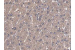 DAB staining on IHC-P; Samples: Human Liver Tissue (ALDH3A1 anticorps  (AA 1-311))