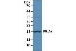 Detection of Recombinant EIF4EBP1, Mouse using Polyclonal Antibody to Eukaryotic Translation Initiation Factor 4E Binding Protein 1 (EIF4EBP1)