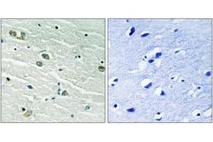 Immunohistochemistry analysis of paraffin-embedded human brain tissue, using MER/SKY (Ab-749/681) Antibody. (MER/SKY (AA 716-765) anticorps)