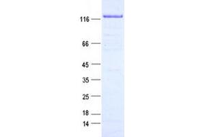Validation with Western Blot