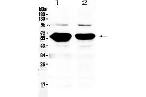 Western blot analysis of Alpha Amylase 1 using anti- Alpha Amylase 1 antibody . (AMY1A, AMY1B, AMY1C (AA 20-50), (N-Term) anticorps)