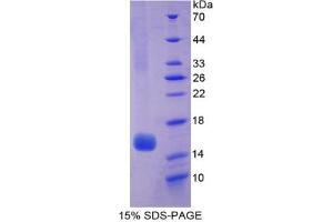 SDS-PAGE analysis of Human Hexosaminidase B beta Protein. (HEXB Protéine)