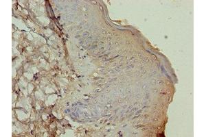 Immunohistochemistry of paraffin-embedded human skin tissue using ABIN7164023 at dilution of 1:100