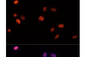 Immunofluorescence analysis of NIH-3T3 cells using PSME3 Polyclonal Antibody at dilution of 1:100 (40x lens).