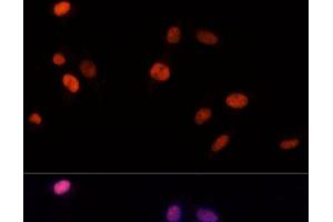 Immunofluorescence analysis of NIH-3T3 cells using PSME3 Polyclonal Antibody at dilution of 1:100 (40x lens). (PSME3 anticorps)