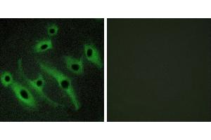Peptide - +Immunofluorescence analysis of HeLa cells, using HER2 antibody. (ErbB2/Her2 anticorps)