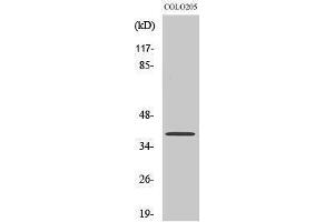 Western Blotting (WB) image for anti-X-Ray Repair Complementing Defective Repair in Chinese Hamster Cells 4 (XRCC4) (C-Term) antibody (ABIN3177959) (XRCC4 anticorps  (C-Term))