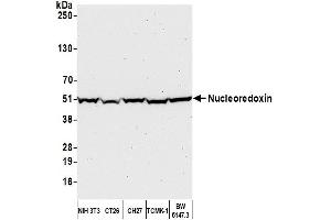 Western Blotting (WB) image for anti-Nucleoredoxin (NXN) (AA 385-435) antibody (ABIN7449243)