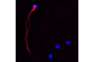 IF on ethanol-fixed human spermatosoid using Mouse monoclonal to Cathelicidin: OSX12 clone  at a concentration of 10 µg/ml.