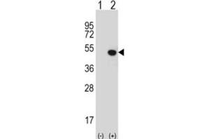 Western Blotting (WB) image for anti-Jumonji Domain Containing 5 (JMJD5) antibody (ABIN2995955) (JMJD5 anticorps)