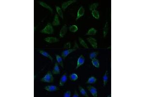 Immunofluorescence analysis of L929 cells using GK2 antibody (ABIN7267458) at dilution of 1:100.