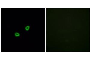 Immunofluorescence analysis of HUVEC cells, using OR1L6 antibody. (OR1L6 anticorps  (Internal Region))