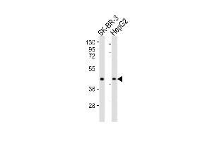 All lanes : Anti-ACAT1 Antibody (C-term) at 1:1000 dilution Lane 1: SK-BR-3 whole cell lysates Lane 2: HepG2 whole cell lysates Lysates/proteins at 20 μg per lane.