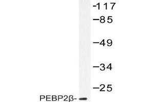 Western blot (WB) analysis of PEBP2beta antibody in extracts from HUVEC (CBFB anticorps)