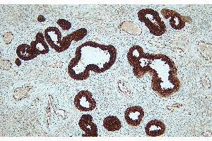 Immunohistochemistry (IHC) image for anti-Prostate Specific Antigen (PSA) (N-Term) antibody (ABIN7598882)