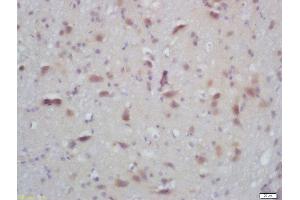 Formalin-fixed and paraffin embedded mouse brain labeled with Rabbit Anti-PKC alpha/beta II (Thr638/641) Polyclonal Antibody, Unconjugated  at 1:200 followed by conjugation to the secondary antibody and DAB staining (PRKCA beta 2 anticorps  (pThr638, pThr641))