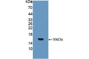 Western blot analysis of recombinant Mouse OCLN. (Occludin anticorps  (AA 17-107))