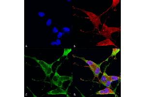 Immunocytochemistry/Immunofluorescence analysis using Mouse Anti-Ankyrin R Monoclonal Antibody, Clone S388A-10 (ABIN2485522).