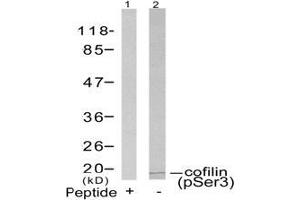 Image no. 3 for anti-Cofilin 1 (CFL1) (pSer3) antibody (ABIN196855) (Cofilin anticorps  (pSer3))