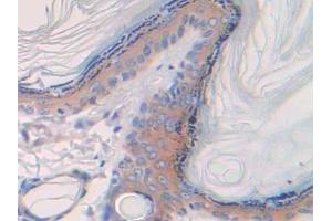 Detection of SPTAN1 in Rat Skin Tissue using Polyclonal Antibody to Alpha-Fodrin (SPTAN1)