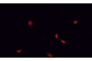 ABIN6268947 staining SHSY5Y? (DREAM anticorps  (Internal Region))
