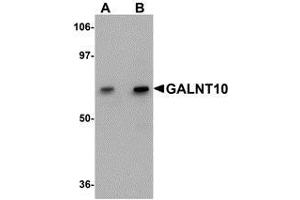 Western blot analysis of GALNT10 in SK-N-SH cell lysate with AP30351PU-N GALNT10 antibody at (A) 1 and (B) 2 μg/ml. (GALNT10 anticorps  (C-Term))