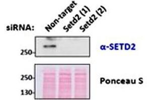 SETD2 polyclonal antibody  (0. (SETD2 anticorps  (Internal Region))