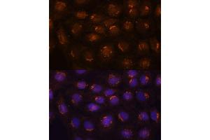 Immunofluorescence analysis of C6 cells using B3GNT4 antibody (ABIN7265875) at dilution of 1:100.
