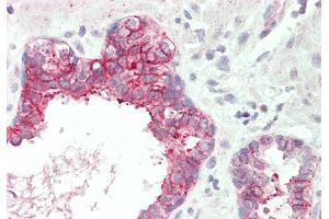 Rabbit Anti-SLC39A5 antibody  Formalin Fixed Paraffin Embedded Tissue: Human Prostate Primary antibody Concentration: 1:100 Secondary Antibody: Donkey anti-Rabbit-Cy3 Secondary Antibody Concentration: 1:200 Magnification: 20x Exposure Time: 0.