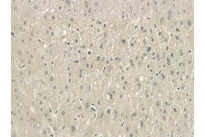 ABIN6261636 and ABIN6276681 at 1/100 staining human normal liver tissue by IHC-P.