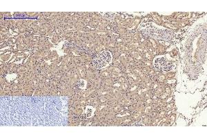 Immunohistochemistry of paraffin-embedded Rat kidney tissue using GLUT-4 Polyclonal Antibody at dilution of 1:200. (GLUT4 anticorps)