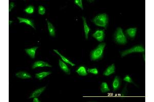 Immunofluorescence of monoclonal antibody to CPVL on HeLa cell. (CPVL anticorps  (AA 1-476))