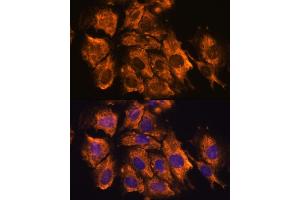 anti-Cysteine-Rich with EGF-Like Domains 1 (CRELD1) (AA 50-150) antibody