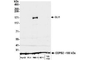 Western Blotting (WB) image for anti-Zinc Finger Protein GLI1 (GLI1) (C-Term) antibody (ABIN7795648)