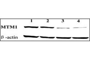 Western blot showing knockdown of endogenous MTM1 expression by MTM1-targeting vectors pD and pD. (MTM1 anticorps  (C-Term))