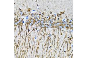 Immunohistochemistry of paraffin-embedded mouse brain using MAP1LC3A antibody (ABIN5998168) at dilution of 1/100 (40x lens). (MAP1LC3A anticorps)