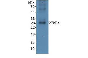WB of Protein Standard: different control antibodies against Highly purified E.