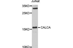 Western blot analysis of extracts of Jurkat cells, using CALCA antibody (ABIN1876765) at 1:1000 dilution. (CGRP anticorps)