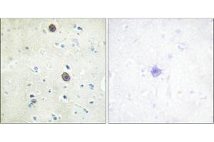 Immunohistochemical analysis of paraffin-embedded human brain tissue using Amyloid β A4 (phospho-Thr743/668) antibody (left)or the same antibody preincubated with blocking peptide (right). (APP anticorps  (pThr668, pThr743))
