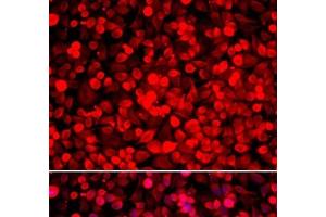 Immunofluorescence analysis of HeLa cells using PUF60 Polyclonal Antibody (PUF60 anticorps)