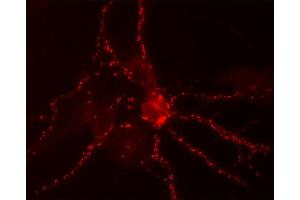 Immunocytochemistry on cultured hippocampus neurons (dilution 1 : 300).