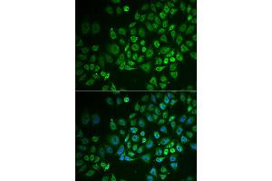 Immunofluorescence analysis of A549 cell using GPLD1 antibody. (GPLD1 anticorps)