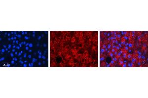 Immunohistochemistry (IHC) image for anti-Ras Homolog Family Member D (RHOD) (N-Term) antibody (ABIN2775403)