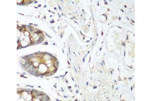 Immunohistochemistry of paraffin-embedded Human colon using FLT4 Polyclonal Antibody at dilution of 1:200 (40x lens). (FLT4 anticorps)