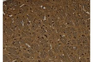 ABIN6274032 at 1/100 staining Rat brain tissue by IHC-P. (HSF1 anticorps  (pSer326))