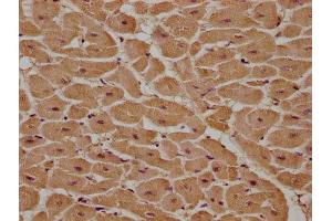 IHC image of ABIN7166480 diluted at 1:100 and staining in paraffin-embedded human heart tissue performed on a Leica BondTM system.